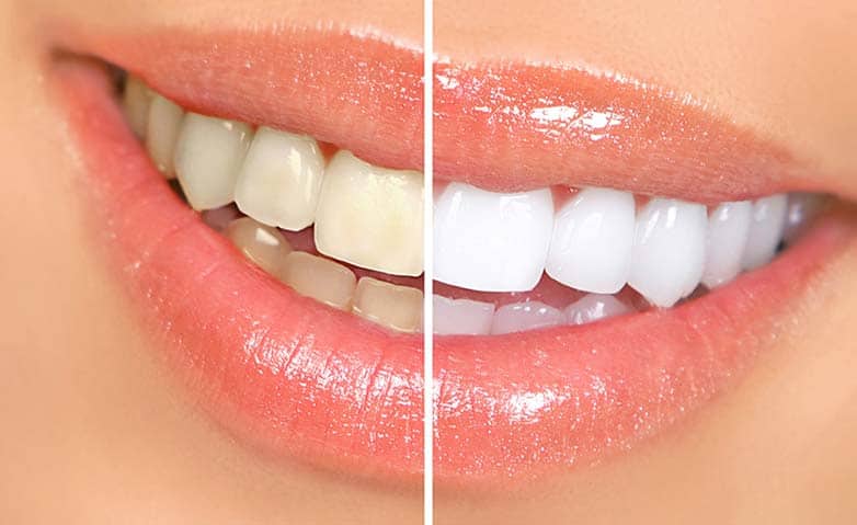 Whiten Teeth In Photos in PaintShop Pro